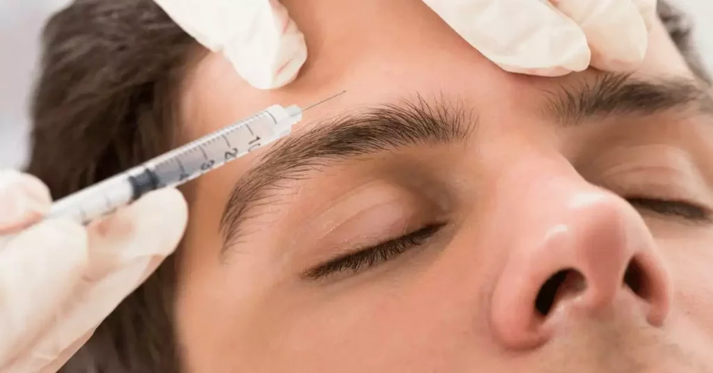 Botox for migraine