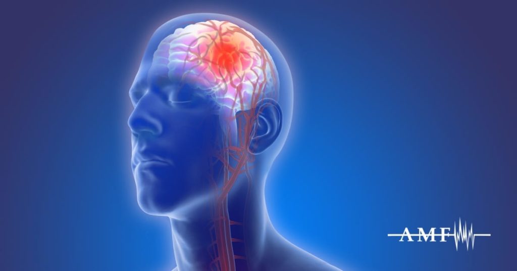 Low CSF Pressure Headache
